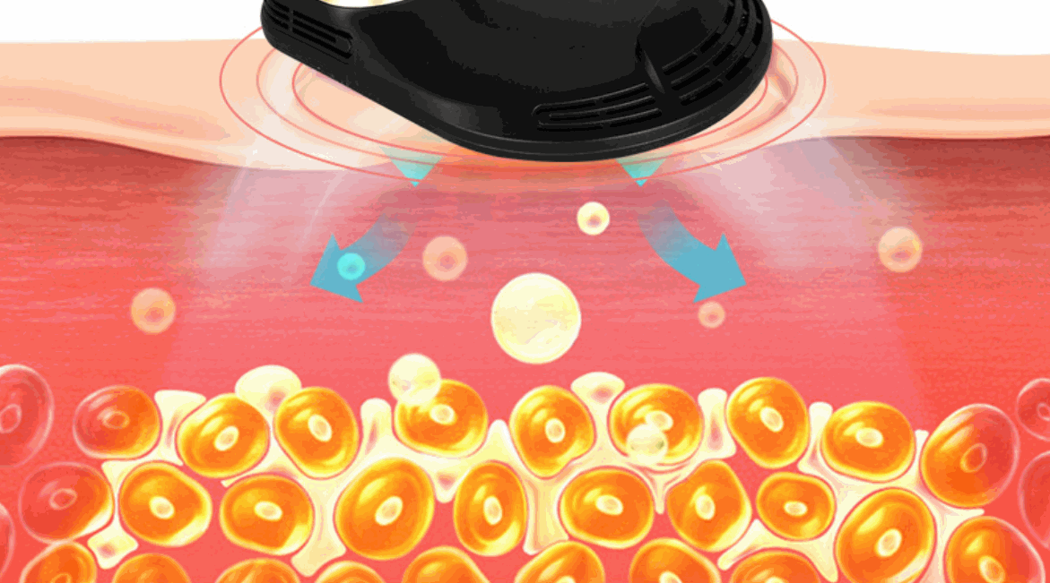 EMS head inside action